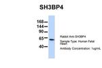 SH3BP4 Polyclonal Antibody