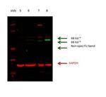 Glutaminase Antibody in Western Blot (WB)