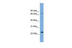 SPG20 Polyclonal Antibody