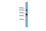 AGTPBP1 Polyclonal Antibody
