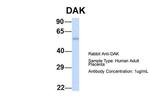 DAK Polyclonal Antibody