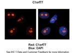 C1orf77 Antibody in Immunohistochemistry (IHC)