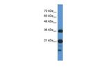 C1orf144 Antibody in Western Blot (WB)