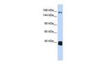 LCOR Polyclonal Antibody