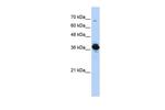 ATP6V0D2 Polyclonal Antibody