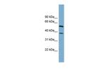 HEPACAM Polyclonal Antibody