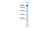 PGM2L1 Antibody in Western Blot (WB)