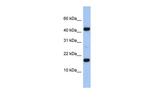 C5orf64 Polyclonal Antibody