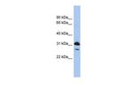 RAP1B Polyclonal Antibody