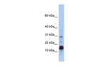 HIST2H2BF Polyclonal Antibody
