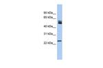 SRSF7 Polyclonal Antibody