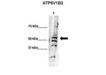 ATP6V1B2 Polyclonal Antibody