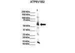 ATP6V1B2 Polyclonal Antibody
