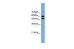 PGM1 Polyclonal Antibody