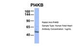 PI4KB Antibody in Western Blot (WB)