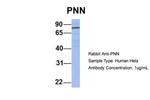 PNN Antibody in Western Blot (WB)