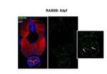 RAB5B Polyclonal Antibody