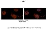 SET Antibody in Immunohistochemistry (IHC)