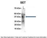 SET Antibody in Immunoprecipitation (IP)