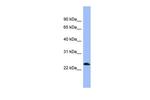 PNOC Polyclonal Antibody