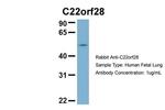 RTCB Antibody in Western Blot (WB)