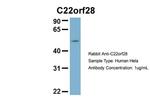 RTCB Antibody in Western Blot (WB)