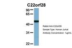 RTCB Antibody in Western Blot (WB)