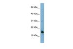 MED31 Polyclonal Antibody