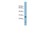 TRAPPC4 Antibody in Western Blot (WB)