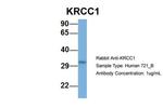 KRCC1 Antibody in Western Blot (WB)