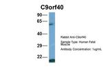 C9orf40 Antibody in Western Blot (WB)