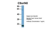 C9orf40 Antibody in Western Blot (WB)