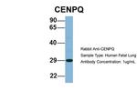 CENPQ Antibody in Western Blot (WB)