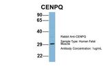 CENPQ Antibody in Western Blot (WB)