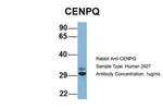 CENPQ Antibody in Western Blot (WB)