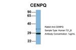 CENPQ Antibody in Western Blot (WB)
