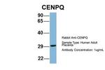 CENPQ Antibody in Western Blot (WB)