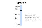 SPATA7 Antibody in Western Blot (WB)