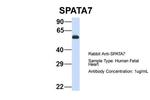 SPATA7 Antibody in Western Blot (WB)
