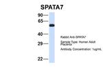 SPATA7 Polyclonal Antibody
