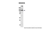 EXOC6 Antibody in Western Blot (WB)
