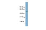 ACTR3B Polyclonal Antibody