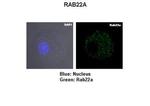RAB22A Polyclonal Antibody