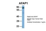 AFAP Polyclonal Antibody