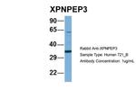 XPNPEP3 Antibody in Western Blot (WB)