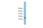 GREM2 Polyclonal Antibody