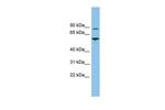 VPS52 Polyclonal Antibody