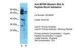 MTRR Polyclonal Antibody