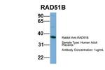 RAD51B Polyclonal Antibody