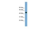 PSMD12 Polyclonal Antibody